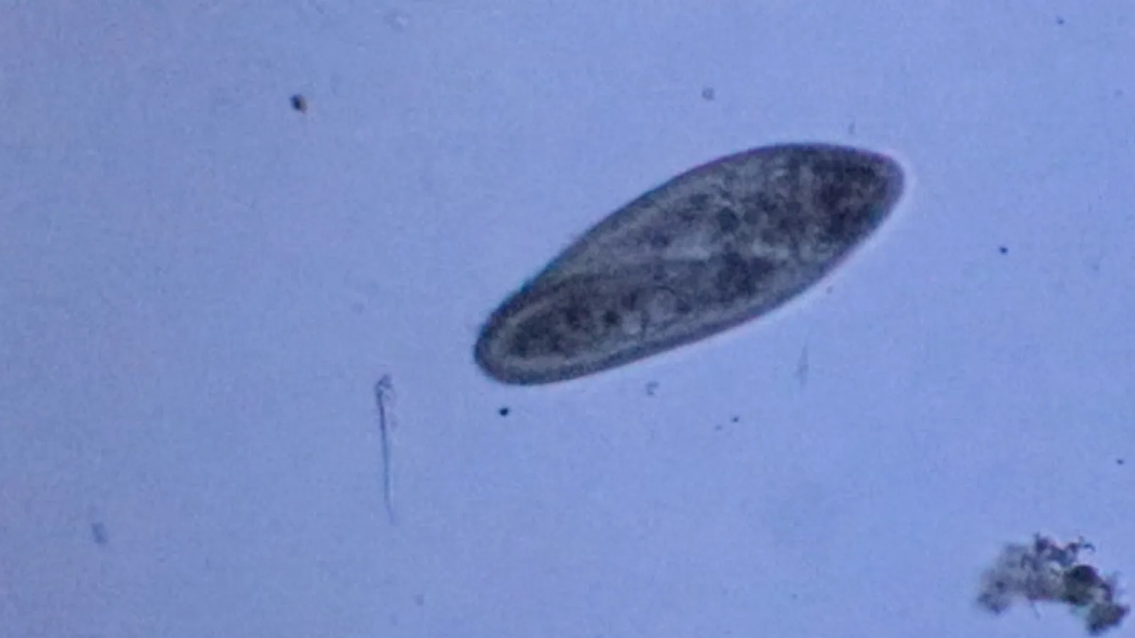 Fotografia documentaria: Paramecium caudatum