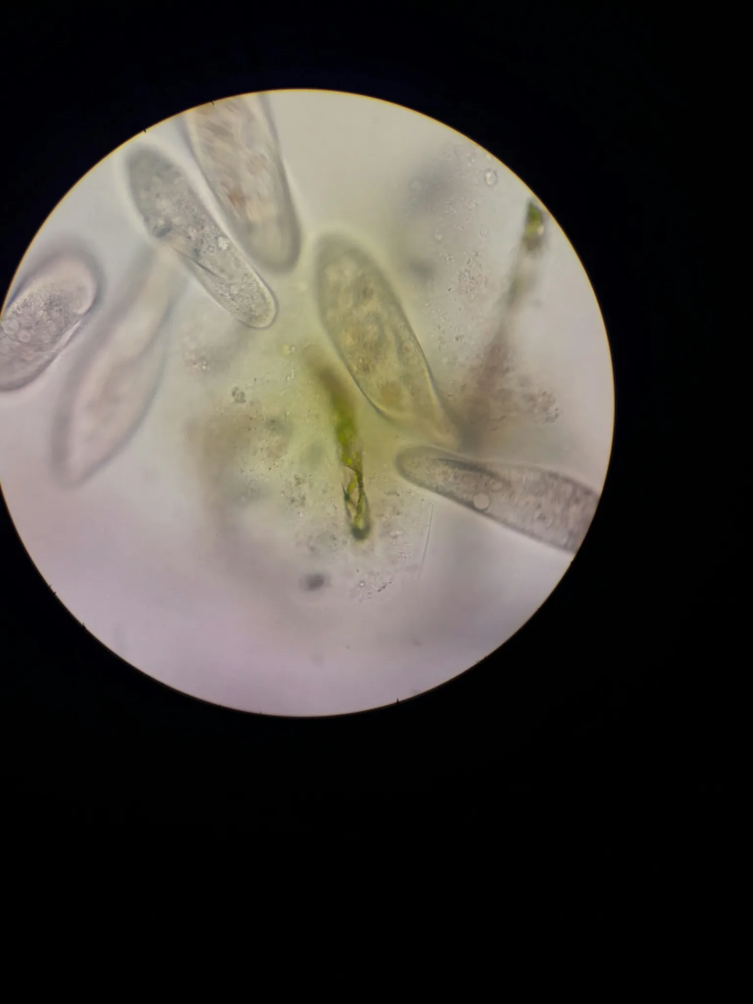 Fotografia documentaria: Paramecium caudatum